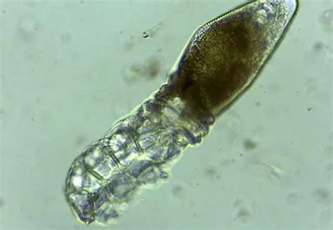  Jasonia! Discover This Microscopic Parasite with a Tentacled Appetite