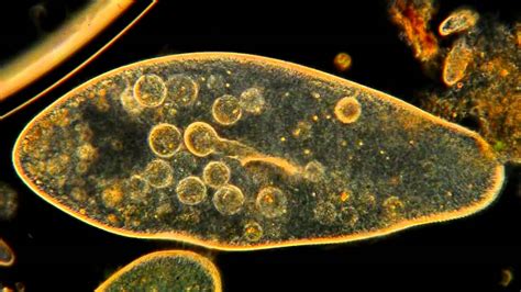  Paramecium! ลองเดาว่าตัวเล็กๆ น้อยๆ ตัวนี้มีวิธีการกินอาหารอย่างไร?