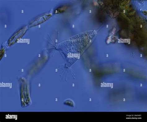  Zimmermannia!  This Ciliate Swims Through Freshwater Like a Tiny Olympian!